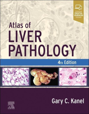 Atlas of Liver Pathology (Atlas of Surgical Pathology) cover